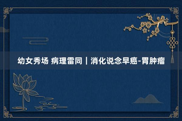 幼女秀场 病理雷同｜消化说念早癌-胃肿瘤